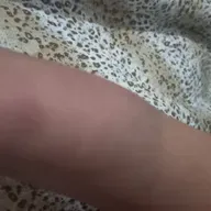 Atos( 12.9)Pedro livre da prisão