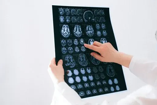 Hiru Hamabi reclama más recursos y reconocimiento para el daño cerebral infantil