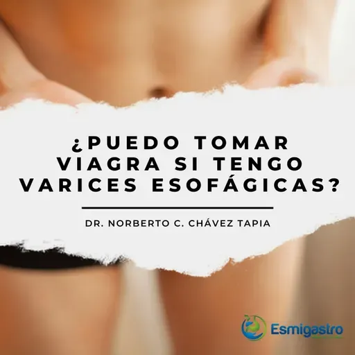 ¿Puedo tomar viagra si tengo varices esofágicas?