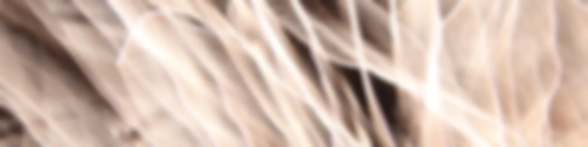  $》☆☆