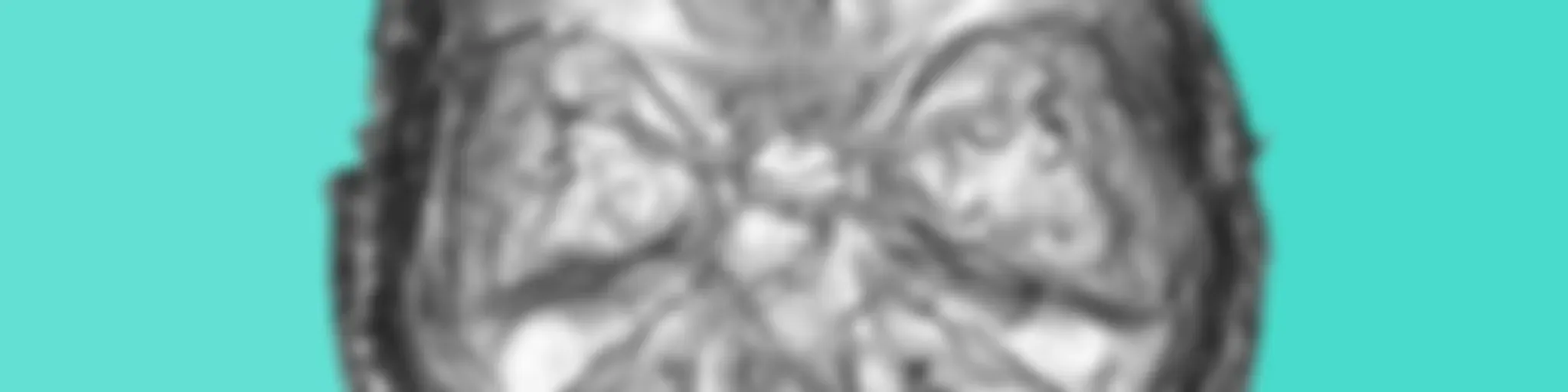 Trastornados Podcast