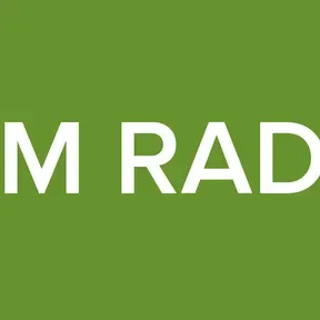 I FM RADIO