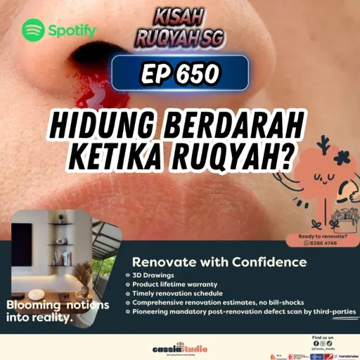 Ep 650: Hidung Berdarah Ketika Ruqyah?