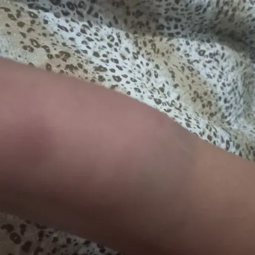 Atos( 12.9)Pedro livre da prisão