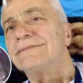 radiobeto