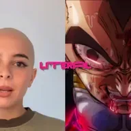 Clersss se está quedando calva