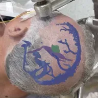 Navian: Jóvenes argentinos crean un solución de navegación y realidad aumentada para cirugías.