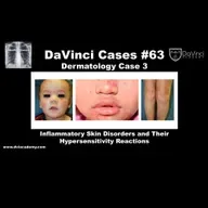 Inflammatory Skin Disorders and Hypersensitivity Reactions  [#DaVinciCases Dermatology Case 3]