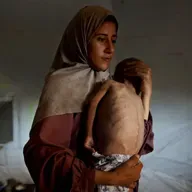 Extreme Hunger In Gaza. France To Recognize Palestinian State