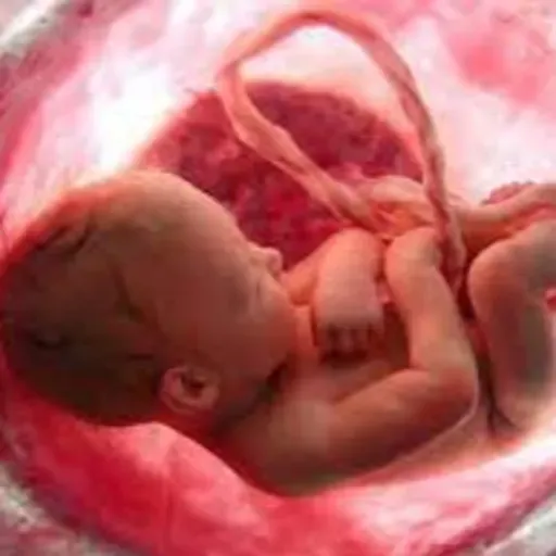 LEGALIZACIÓN DE ABORTO MENTIRAS Y VERDADES