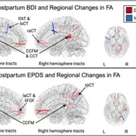 The new science of 'dad brain'