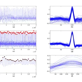 Frequency radio