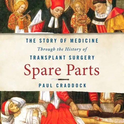 The History of Transplant Surgery