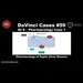 Pharmacology of Peptic Ulcer Disease [#DaVinciCases GI 9 - Pharmacology Case 1]