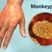 Monkeypox: sexta morte no Brasil acende o alerta para a prevenção