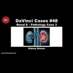 #DaVinciCases Renal 8 - Pathology Case 3