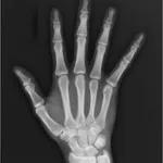 Interesting facts about X-RAY