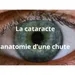 5°épisode  de l'enquête sur la Vieillesse: : Patrice Marcadé :"La cataracte, anatomie d'une chute"