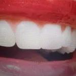 10 curiosidades sobre os dentes - DSOral.