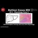 Acetaminophen Toxicity and Liver Zone Physiology [#DaVinciCases GI 5 - Physiology Case 3]