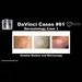 Annular Rashes and Microscopy  [#DaVinciCases Dermatology Case 1]
