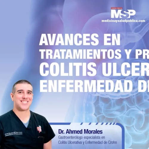 Avances y tratamientos y prevención de la Colitis Ulcerativa y Enfermedad de Crohn